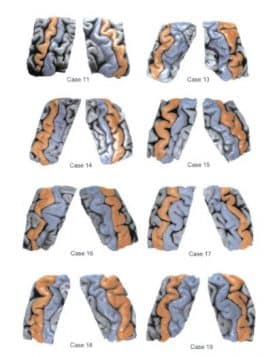 figure 2 from article Duke and world 20160829