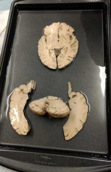 axial brain slices